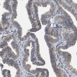 Invitrogen Coronin 2B Polyclonal Antibody 100 &mu;L; Unconjugated:Antibodies,
