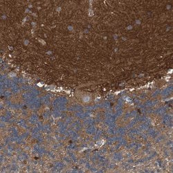 Invitrogen Coronin 2B Polyclonal Antibody 100 &mu;L; Unconjugated:Antibodies,