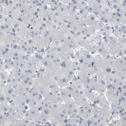 Invitrogen Coronin 2B Polyclonal Antibody 100 &mu;L; Unconjugated:Antibodies,