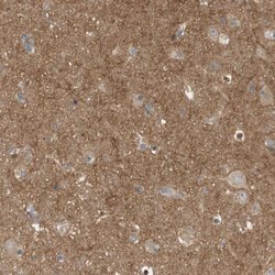 Invitrogen Coronin 2B Polyclonal Antibody 100 &mu;L; Unconjugated:Antibodies,
