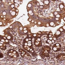Invitrogen LSM14A Polyclonal Antibody 100 &mu;L; Unconjugated:Antibodies,