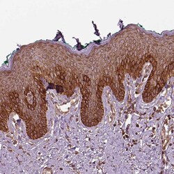 Invitrogen LSM14A Polyclonal Antibody 100 &mu;L; Unconjugated:Antibodies,