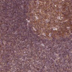 Invitrogen LSM14A Polyclonal Antibody 100 &mu;L; Unconjugated:Antibodies,