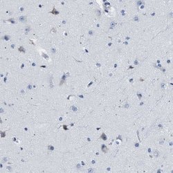 Invitrogen HLA-DPA1 Polyclonal Antibody 100 &mu;L; Unconjugated:Antibodies,