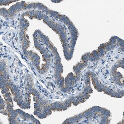 Invitrogen BCKDK Polyclonal Antibody 100 &mu;L; Unconjugated:Antibodies,