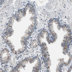 Invitrogen BCKDK Polyclonal Antibody 100 &mu;L; Unconjugated:Antibodies,