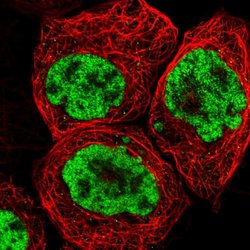 Invitrogen FOXK1 Polyclonal Antibody 100 &mu;L; Unconjugated:Antibodies,