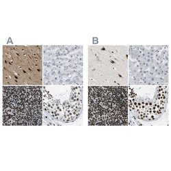 Invitrogen FOXK1 Polyclonal Antibody 100 &mu;L; Unconjugated:Antibodies,