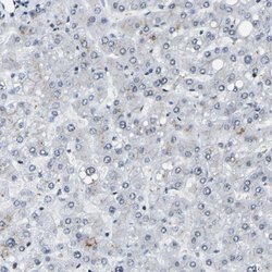 Invitrogen FOXK1 Polyclonal Antibody 100 &mu;L; Unconjugated:Antibodies,