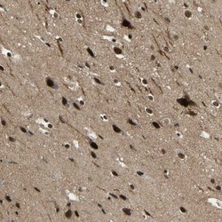 Invitrogen FOXK1 Polyclonal Antibody 100 &mu;L; Unconjugated:Antibodies,