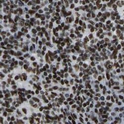 Invitrogen FOXK1 Polyclonal Antibody 100 &mu;L; Unconjugated:Antibodies,