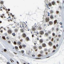Invitrogen FOXK1 Polyclonal Antibody 100 &mu;L; Unconjugated:Antibodies,