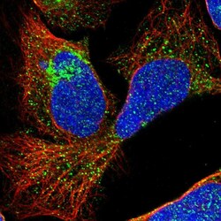 Invitrogen TMEM180 Polyclonal Antibody 100 &mu;L; Unconjugated:Antibodies,