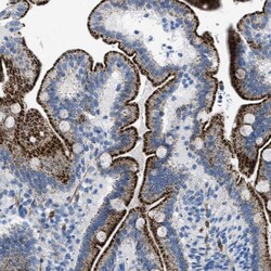 Invitrogen TMEM180 Polyclonal Antibody 100 &mu;L; Unconjugated:Antibodies,