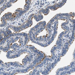 Invitrogen TMEM180 Polyclonal Antibody 100 &mu;L; Unconjugated:Antibodies,
