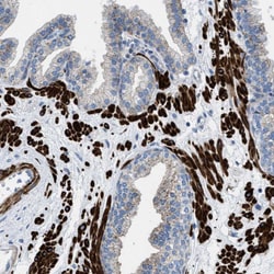 Invitrogen TMEM180 Polyclonal Antibody 100 &mu;L; Unconjugated:Antibodies,