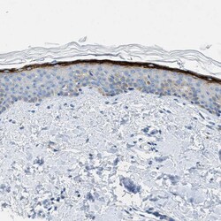 Invitrogen TMEM180 Polyclonal Antibody 100 &mu;L; Unconjugated:Antibodies,