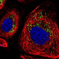 Invitrogen DRAM2 Polyclonal Antibody 100 &mu;L; Unconjugated:Antibodies,