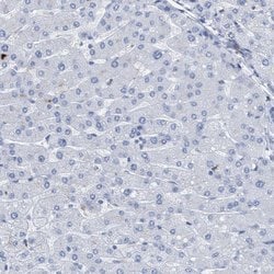 Invitrogen DRAM2 Polyclonal Antibody 100 &mu;L; Unconjugated:Antibodies,