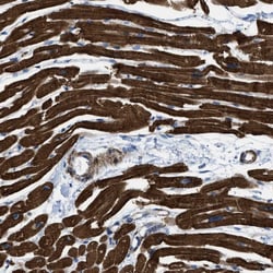 Invitrogen KCNH7 Polyclonal Antibody 100 &mu;L; Unconjugated:Antibodies,
