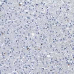 Invitrogen KV3.3 (KCNC3) Polyclonal Antibody 100 &mu;L | Buy Online | Invitrogen&trade; | Fisher Scientific