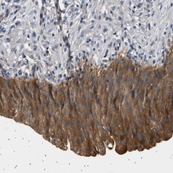 Invitrogen PPAPDC2 Polyclonal Antibody 100 &mu;L; Unconjugated:Antibodies,