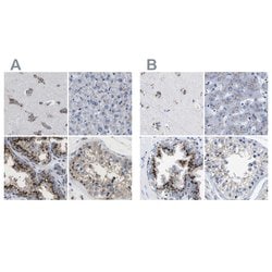 Invitrogen TMEM87A Polyclonal Antibody 100 &mu;L; Unconjugated:Antibodies,