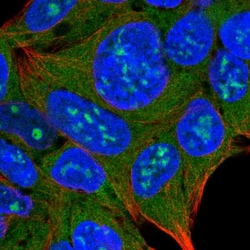 Invitrogen TRPML3 Polyclonal Antibody 100 &mu;L; Unconjugated:Antibodies,