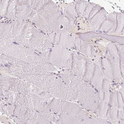 Invitrogen TRPML3 Polyclonal Antibody 100 &mu;L; Unconjugated:Antibodies,