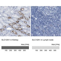 Invitrogen NKCC2 Polyclonal Antibody 100 μL; Unconjugated:Antibodies,