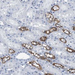 Invitrogen NKCC2 Polyclonal Antibody 100 μL; Unconjugated:Antibodies,