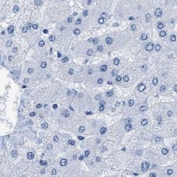Invitrogen NKCC2 Polyclonal Antibody 100 μL; Unconjugated:Antibodies,