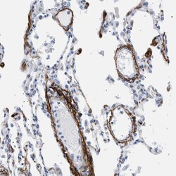 Invitrogen Elastin Polyclonal Antibody 100 &mu;L; Unconjugated:Anticorps,