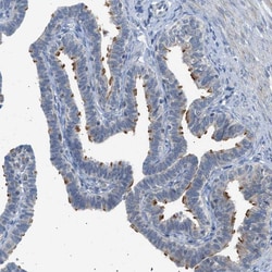 Invitrogen TTBK2 Polyclonal Antibody 100 &mu;L | Buy Online | Invitrogen&trade; | Fisher Scientific