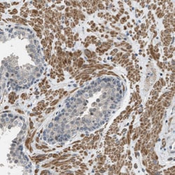 Invitrogen TTBK2 Polyclonal Antibody 100 &mu;L | Buy Online | Invitrogen&trade; | Fisher Scientific