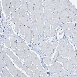 Invitrogen TTBK2 Polyclonal Antibody 100 &mu;L | Buy Online | Invitrogen&trade; | Fisher Scientific