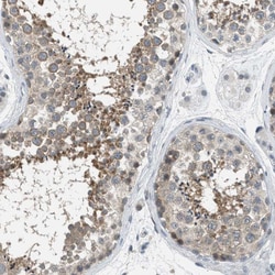 Invitrogen TTBK2 Polyclonal Antibody 100 &mu;L | Buy Online | Invitrogen&trade; | Fisher Scientific