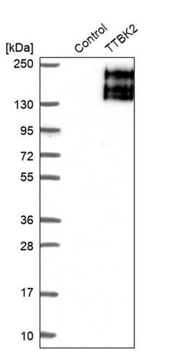 Invitrogen TTBK2 Polyclonal Antibody 100 &mu;L | Buy Online | Invitrogen&trade; | Fisher Scientific