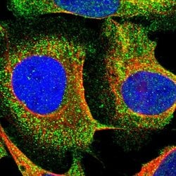 Invitrogen SMPD2 Polyclonal Antibody 100 &mu;L; Unconjugated:Antibodies,