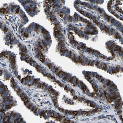 Invitrogen SMPD2 Polyclonal Antibody 100 &mu;L; Unconjugated:Antibodies,