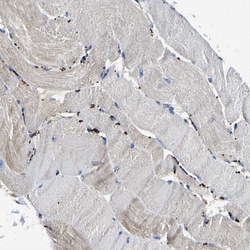 Invitrogen SMPD2 Polyclonal Antibody 100 &mu;L; Unconjugated:Antibodies,