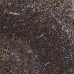 Invitrogen SMPD2 Polyclonal Antibody 100 &mu;L; Unconjugated:Antibodies,