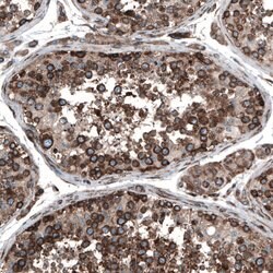 Invitrogen GPIP137 Polyclonal Antibody 100 &mu;L; Unconjugated:Antibodies,