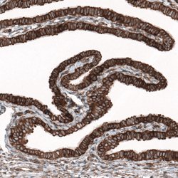 Invitrogen GPIP137 Polyclonal Antibody 100 &mu;L; Unconjugated:Antibodies,