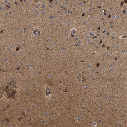 Invitrogen NAV1 Polyclonal Antibody 100 &mu;L; Unconjugated:Antibodies,