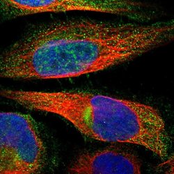 Invitrogen ZNHIT6 Polyclonal Antibody 100 &mu;L; Unconjugated:Antibodies,