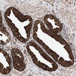 Invitrogen ZNHIT6 Polyclonal Antibody 100 &mu;L; Unconjugated:Antibodies,