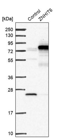 Invitrogen ZNHIT6 Polyclonal Antibody 100 &mu;L; Unconjugated:Antibodies,
