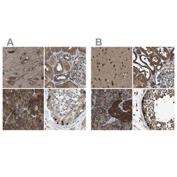 Invitrogen ARFGAP2 Polyclonal Antibody 100 &mu;L; Unconjugated:Antibodies,