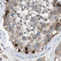 Invitrogen ARFGAP2 Polyclonal Antibody 100 &mu;L; Unconjugated:Antibodies,